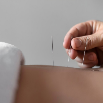 close-up-hand-holding-acupuncture-needle_23-2148815311